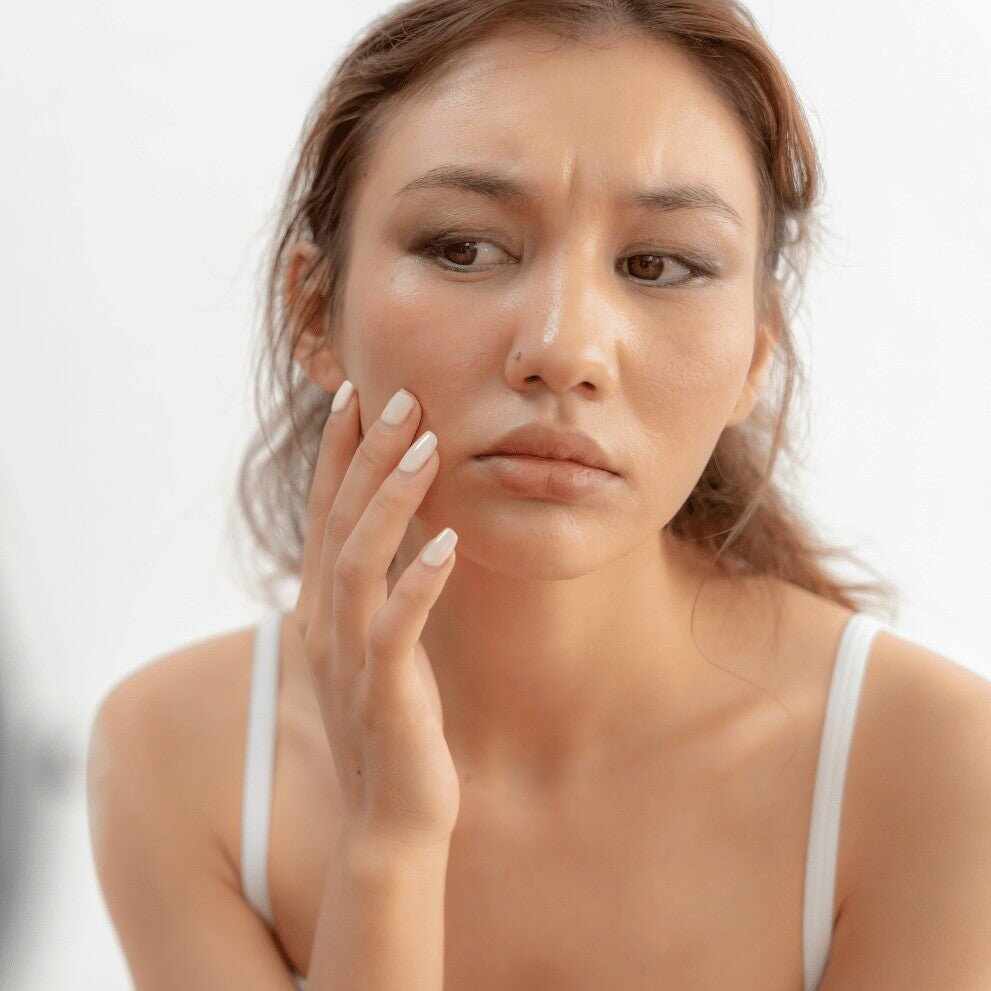 Donna con capelli castani chiari tocca il viso affetto da dermatite